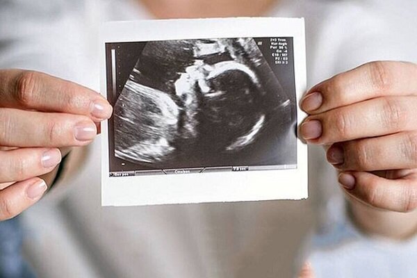 ویزیت رایگان مادران باردار ادامه دارد ویزیت رایگان مادران باردار ادامه دارد