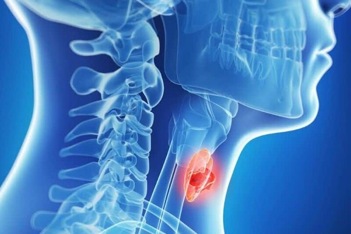مهمترین بیماریهای غده تیروئید را بشناسید مهمترین بیماریهای غده تیروئید را بشناسید