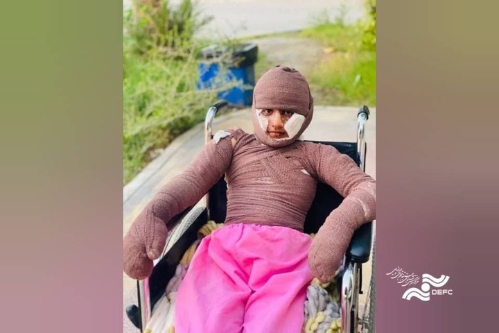 «هدا»، دختری از میناب/ مستندی درباره یکی از بازماندگان جنگ رمضان «هدا»، دختری از میناب/ مستندی درباره یکی از بازماندگان جنگ رمضان
