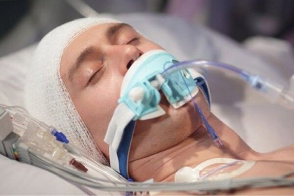 ضربه به سر ممکن است سلامت روده را مختل کند ضربه به سر ممکن است سلامت روده را مختل کند