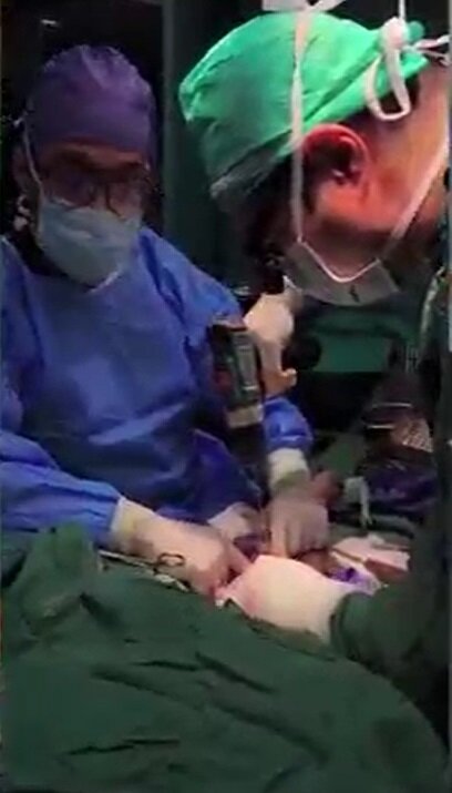 یک جراحی کمنظیر در بروجرد؛ دست قطعشده نوجوان دوباره به بدن بازگشت یک جراحی کمنظیر در بروجرد؛ دست قطعشده نوجوان دوباره به بدن بازگشت